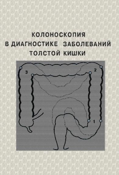 В.Н. Сотников. Колоноскопия в диагностике заболеваний толстой кишки
